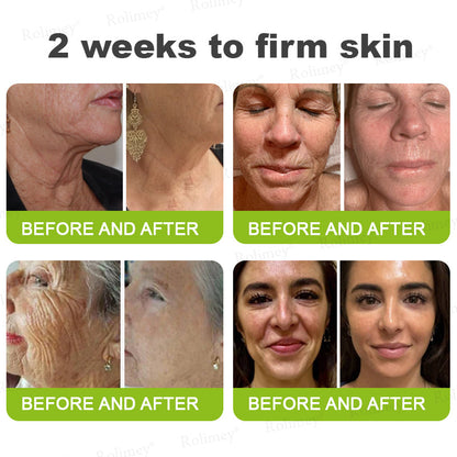 👍🌟💫Made and shipped from Canada 💫Rolimey® Botox & Vita-A Retinol Shot Wrinkle-Lift Tightening cream - Last Day Promotion 70% OFF