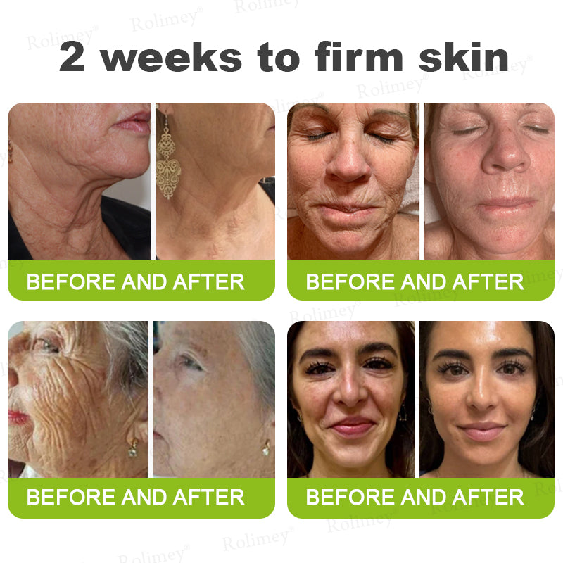 👨‍⚕️Made and Shipped from the Canada ✅Rolimey® Botox & Vita-A Retinol Shot Wrinkle-Lift Tightening stick- Last Day Promotion 70% OFF🔥LAST DAY 70% OFF