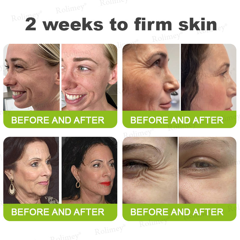 👍🌟💫Made and shipped from Canada 💫Rolimey® Botox & Vita-A Retinol Shot Wrinkle-Lift Tightening cream - Last Day Promotion 70% OFF
