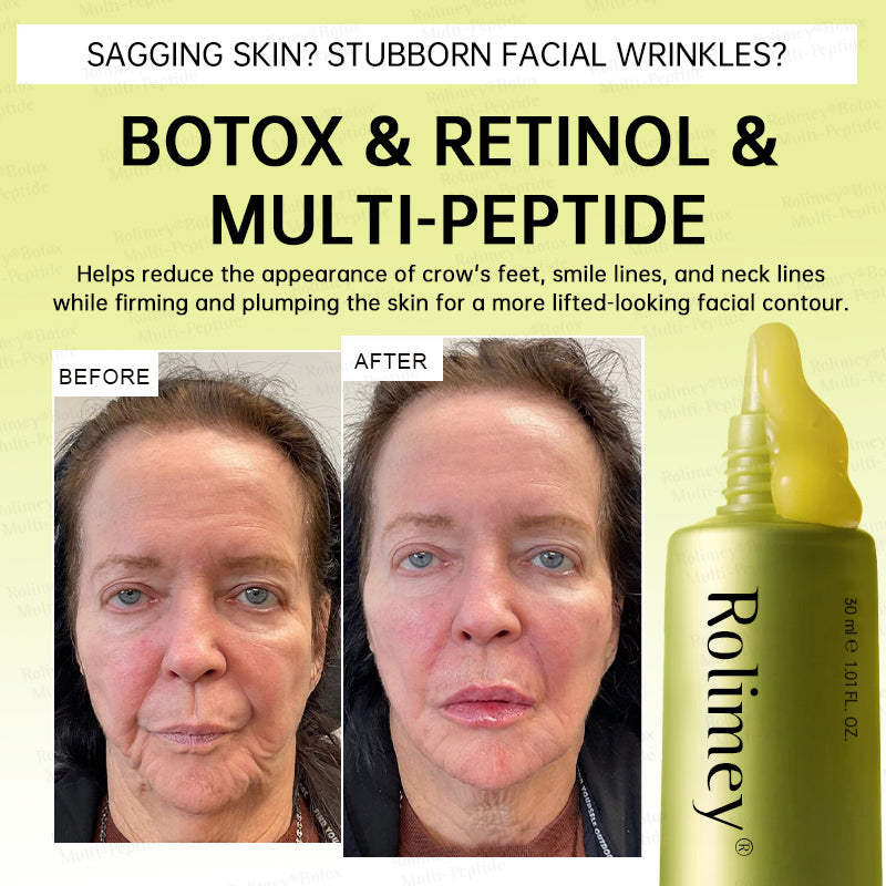 🍃🪄🌟Rolimey® Multi-Peptide Retinol Shot Age-Reset Wrinkle-Lift Cream