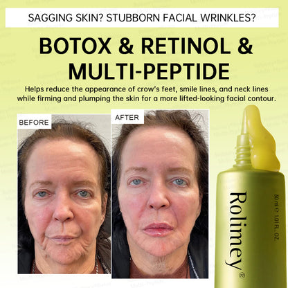 🍃🪄🌟Rolimey® Multi-Peptide Retinol Shot Age-Reset Wrinkle-Lift Cream