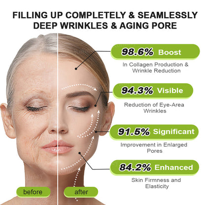👨‍⚕️Made and Shipped from the Canada ✅Rolimey® Botox & Vita-A Retinol Shot Wrinkle-Lift Tightening stick- Last Day Promotion 70% OFF🔥LAST DAY 70% OFF