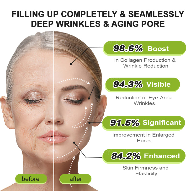 👍🌟💫Made and shipped from Canada 💫Rolimey® Botox & Vita-A Retinol Shot Wrinkle-Lift Tightening cream - Last Day Promotion 70% OFF