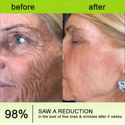 👍🌟💫Made and shipped from Canada 💫Rolimey® Botox & Vita-A Retinol Shot Wrinkle-Lift Tightening cream - Last Day Promotion 70% OFF
