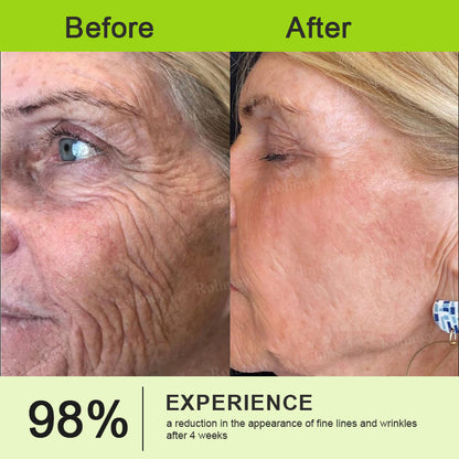 👨‍⚕️Made and Shipped from the Canada ✅Rolimey® Botox & Vita-A Retinol Shot Wrinkle-Lift Tightening stick- Last Day Promotion 70% OFF🔥LAST DAY 70% OFF