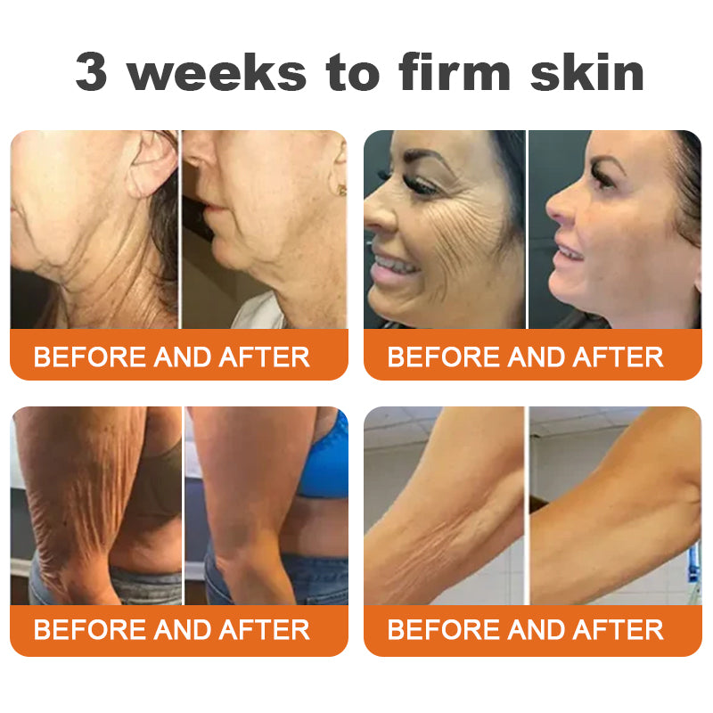 (✨Made and Shipped from Canada👨‍⚕️)✨Flysmus™ Botox Bee Venom Firming Serum Stick🔥LAST DAY 70% OFF
