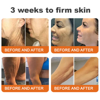 (✨Made and Shipped from Canada👨‍⚕️)✨Flysmus™ Botox Bee Venom Firming Serum Stick🔥LAST DAY 70% OFF