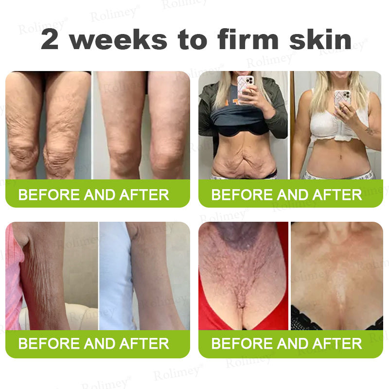 👨‍⚕️Made and Shipped from the Canada ✅Rolimey® Botox & Vita-A Retinol Shot Wrinkle-Lift Tightening stick- Last Day Promotion 70% OFF🔥LAST DAY 70% OFF