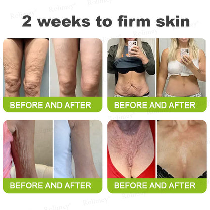 👨‍⚕️Made and Shipped from the Canada ✅Rolimey® Botox & Vita-A Retinol Shot Wrinkle-Lift Tightening stick- Last Day Promotion 70% OFF🔥LAST DAY 70% OFF