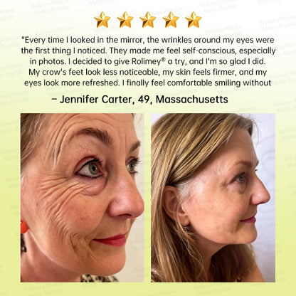 🍃🪄🌟Rolimey® Multi-Peptide Retinol Shot Age-Reset Wrinkle-Lift Cream