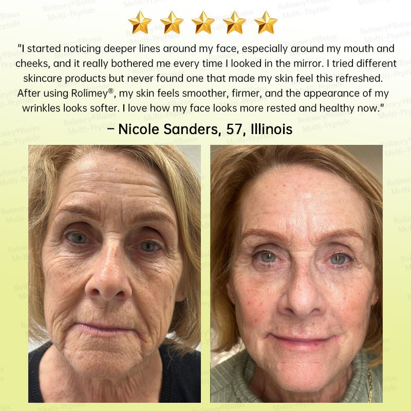 🍃🪄🌟Rolimey® Multi-Peptide Retinol Shot Age-Reset Wrinkle-Lift Cream