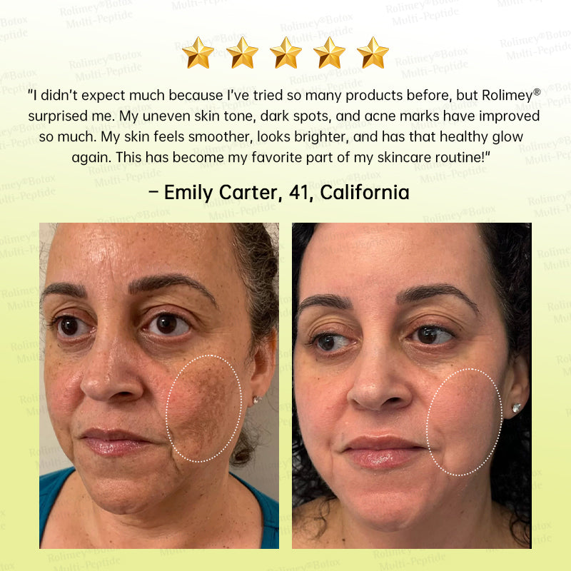 🍃🪄🌟Rolimey® Multi-Peptide Retinol Shot Age-Reset Wrinkle-Lift Cream