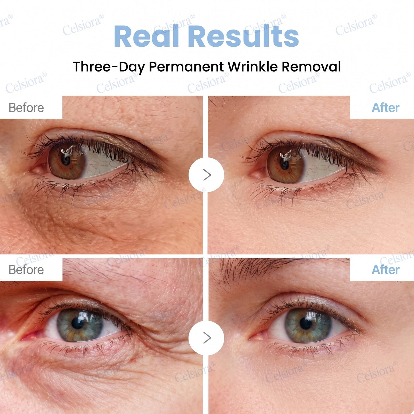 🎉Celsiora® PDRN Anti-Wrinkle Shot – Lift & Firming Cream-UPSELL