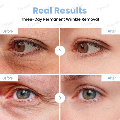 🎉Celsiora® PDRN Anti-Wrinkle Shot – Lift & Firming Cream-UPSELL