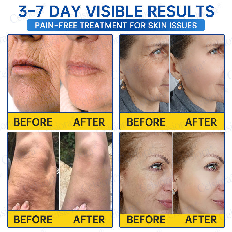 🎉Celsiora® PDRN Anti-Wrinkle Shot – Lift & Firming Cream-UPSELL
