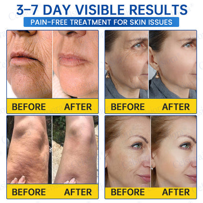 🎉Celsiora® PDRN Anti-Wrinkle Shot – Lift & Firming Cream-UPSELL