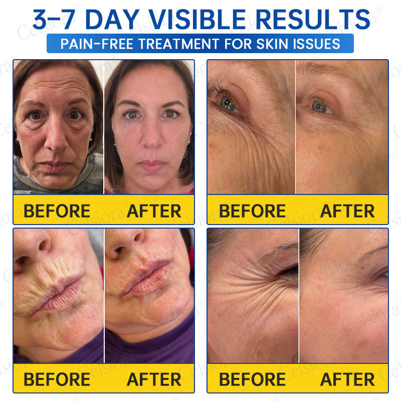 🎉Celsiora® PDRN Anti-Wrinkle Shot – Lift & Firming Cream-UPSELL