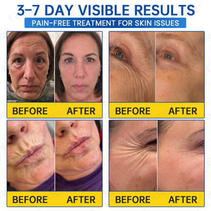 🎉Celsiora® PDRN Anti-Wrinkle Shot – Lift & Firming Cream-UPSELL