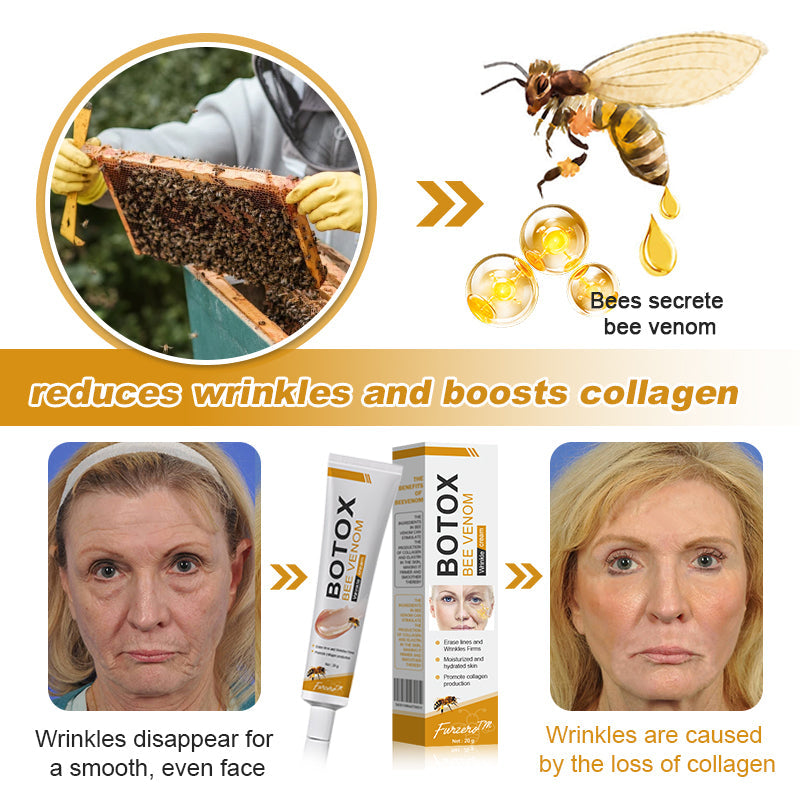 (💎🔥🌿Made and shipped from Canada👨‍⚕️) Furzero™ Botox Bee Venom Wrinkle Removal Cream- LAST DAY 70% OFF