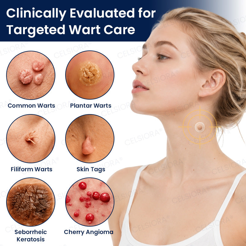 🙌✨GFOUK® 7-Day MicroNeedle Wart & Skin Tag Removal Patch