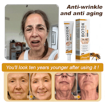 (💎🔥🌿Made and shipped from Canada👨‍⚕️) Furzero™ Botox Bee Venom Wrinkle Removal Cream- LAST DAY 70% OFF
