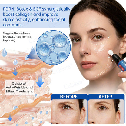 🎉Celsiora® PDRN Anti-Wrinkle Shot – Lift & Firming Cream-UPSELL
