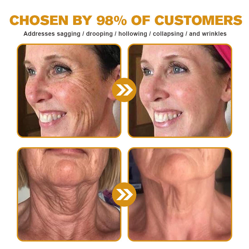 (💎🔥🌿Made and shipped from Canada👨‍⚕️) Furzero™ Botox Bee Venom Wrinkle Removal Cream- LAST DAY 70% OFF