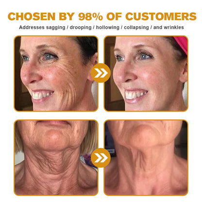 (💎🔥🌿Made and shipped from Canada👨‍⚕️) Furzero™ Botox Bee Venom Wrinkle Removal Cream- LAST DAY 70% OFF